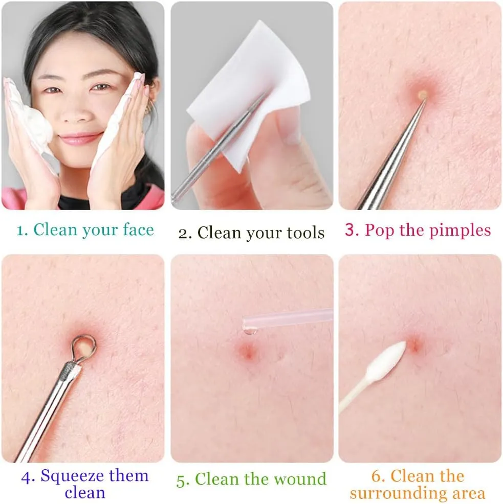 Ten-Piece Set Fecong Stainless Steel Blackhead Removal Kit, Fecong Stainless Steel Blackhead Removal Kit, Acssart Blackhead Remover, Equipped with 15x Magnifying Glass (8-Piece Set)