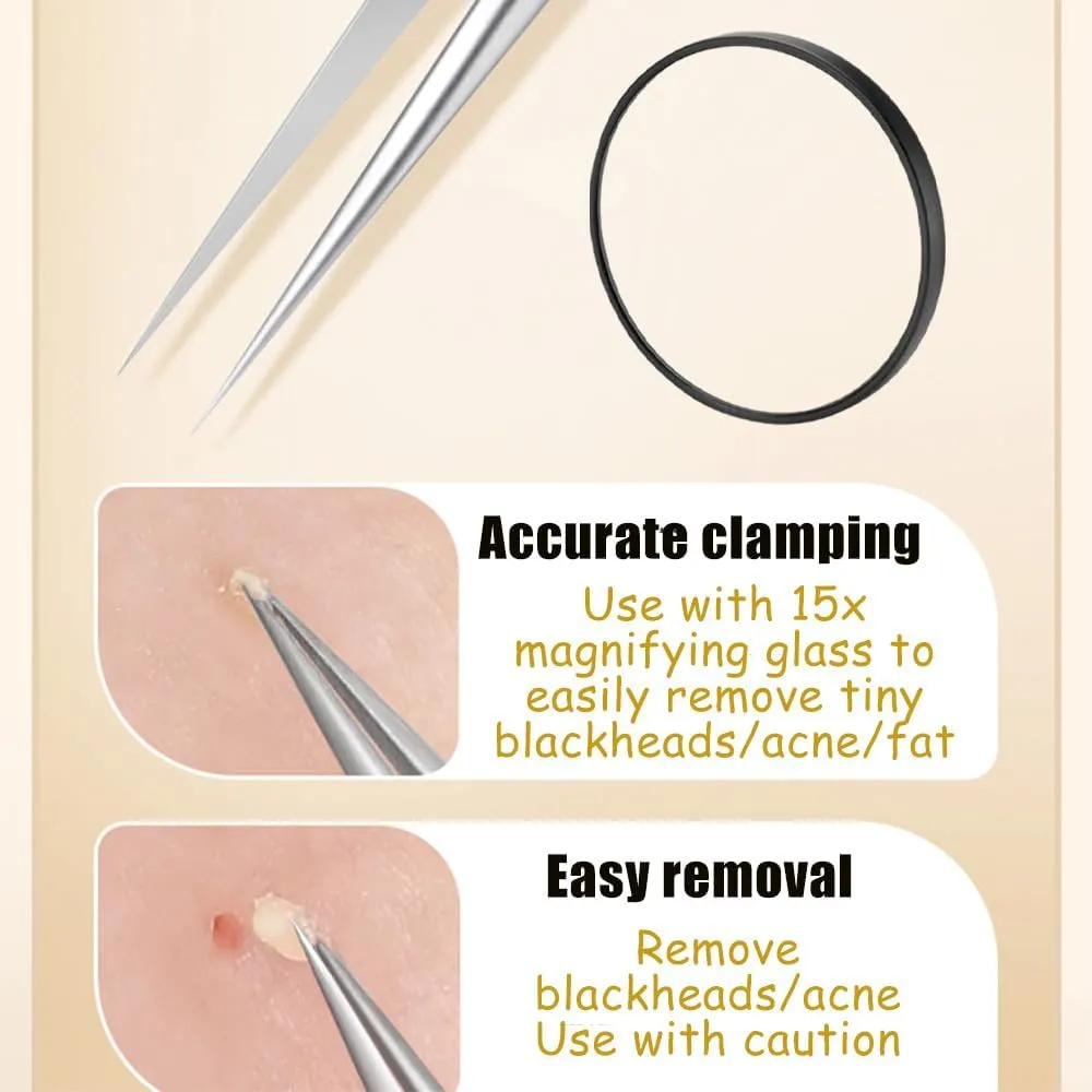 Ten-Piece Set Fecong Stainless Steel Blackhead Removal Kit, Fecong Stainless Steel Blackhead Removal Kit, Acssart Blackhead Remover, Equipped with 15x Magnifying Glass (8-Piece Set)